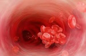 Arterial Pulmonary embolism